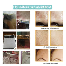Charger l'image dans la galerie, Épurateur de peau à ultrason

