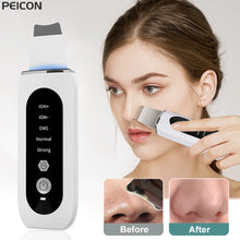 Charger l'image dans la galerie, Épurateur de peau à ultrason
